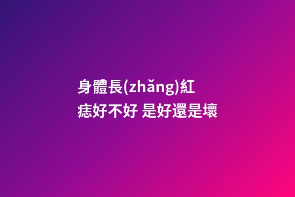 身體長(zhǎng)紅痣好不好 是好還是壞